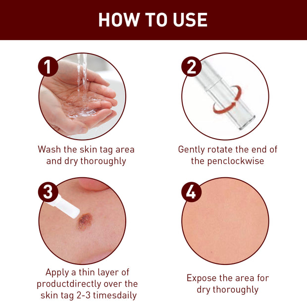 Tags and Moles Remover