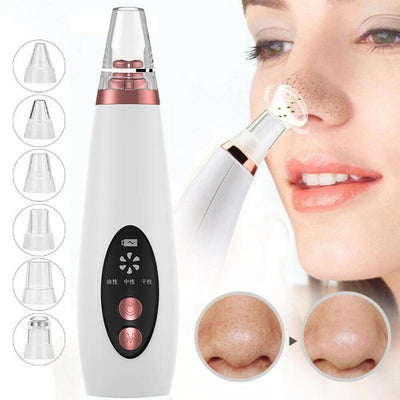 Blackhead Pore Vacuum Cleaner Nose Cleanser Blackheads Remover Blackhead Acne Removal Button Face Suction Beauty Skin Care Tool - Peakvitality Fitness